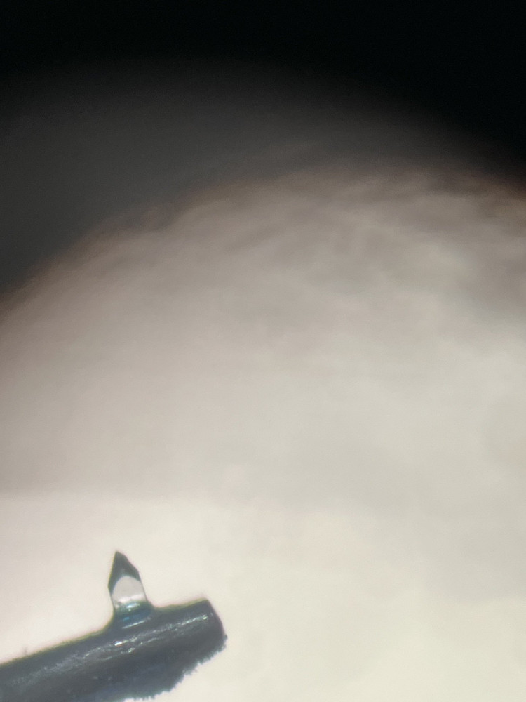 mikroszkópos kép 2